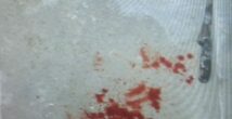 Вечером в Хайфе произошла поножовщина: пострадавший в тяжёлом состоянии