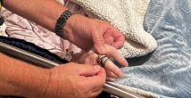 Кольца пришлось разрезать: волонтеры пришли на помощь пожилой женщине